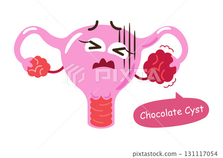 Endometriosis or chocolate cyst . Uterus cartoon character illustration . Isolated white background . Vector . 131117054