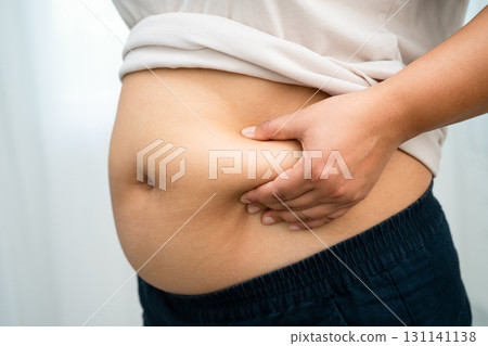 Asian woman use hand to squeeze fat belly big size overweight and obesity. 131141138