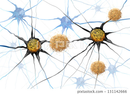Amyloid Beta And Tau 131142666