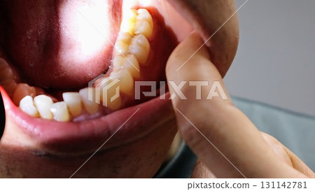 用燈光照射牙齒的人 131142781