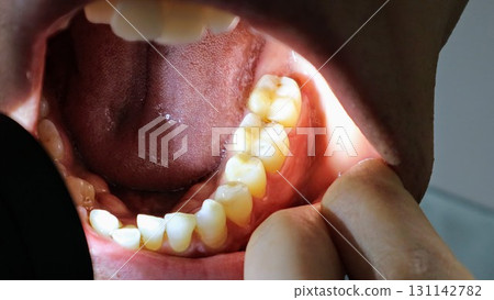 用燈光照射牙齒的人 131142782