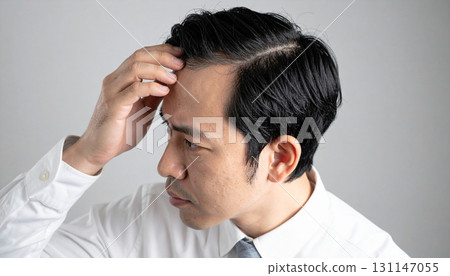 A young man's head concerned about thinning hair (AI-generated image) A young man's head concerned about thinning hair (AI-generated image) 131147055