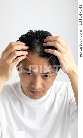 A young man concerned about his thinning hair (AI-generated image) 131147241