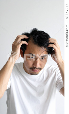 A young man concerned about his thinning hair (AI-generated image) 131147242