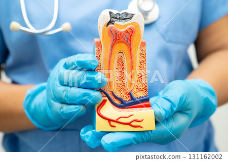 Dentist holding dental implant, artificial tooth roots into jaw, root canal of dental treatment, gum disease, teeth model for dentist. Dentist holding dental implant, artificial tooth roots into jaw, root canal of dental treatment, gum disease, teeth model for dentist. 131162002