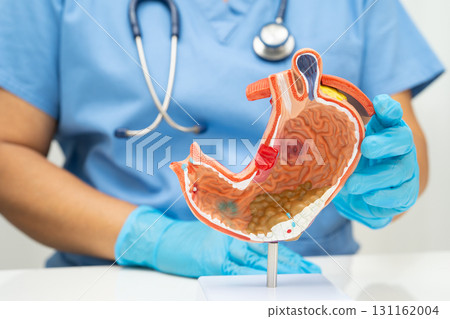 Stomach disease, doctor holding anatomy model for study diagnosis and treatment in hospital. 131162004