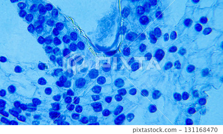 Lillium 0vary 131168470