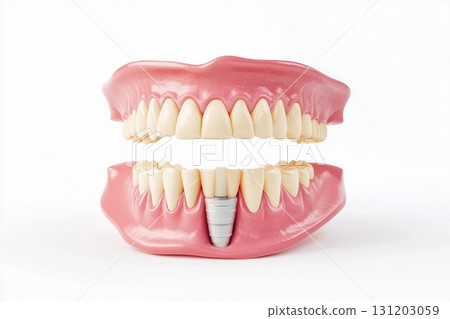 Dental implant positioned securely in the jaw surrounded by natural teeth demonstrating effective oral restoration 131203059