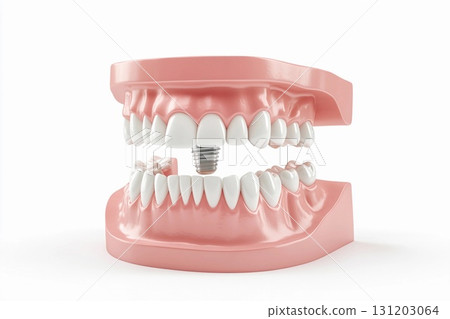 Dental implant positioned securely in the jaw surrounded by natural teeth demonstrating effective oral restoration 131203064