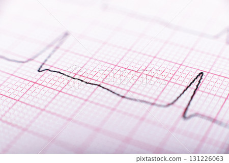 Health care background of Electrocardiogram plot Health care background of Electrocardiogram plot 131226063