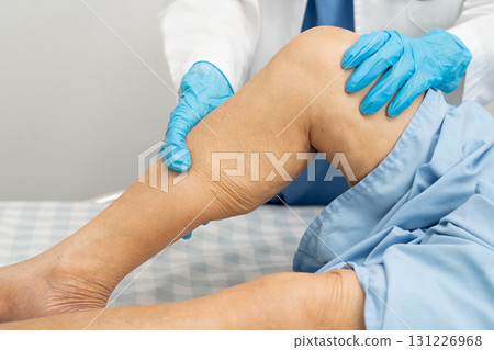 Doctor checking Asian elderly woman patient with scar knee replacement surgery in hospital. 131226968