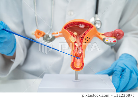 Doctor holding human uterus model for vaginal and cervix pap smear check up in the obstetrics and gynecology. 131226975