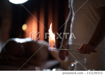 Close up of a traditional fire cupping therapy session with glass cups placed on a patients back and therapist using fire to create suction, promoting relaxation and healing. Close up of a traditional fire cupping therapy session with glass cups placed on a patients back and therapist using fire to create suction, promoting relaxation and healing. 131236553