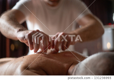 Close up of therapist applying cupping therapy on male clients back during wellness and rehabilitation treatment, traditional alternative medicine for relaxation and pain relief. 131236993