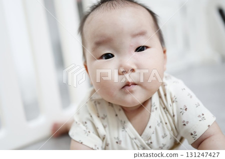 一名嬰兒因被昆蟲叮咬而左眼周圍發紅。 一名嬰兒因被昆蟲叮咬而左眼周圍發紅。 131247427