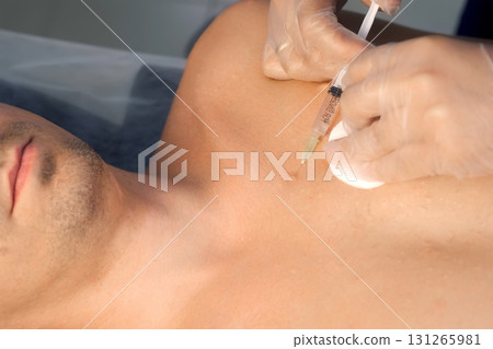 Surgeon gives injection of local anesthesia during laser removing mole on chest. 131265981