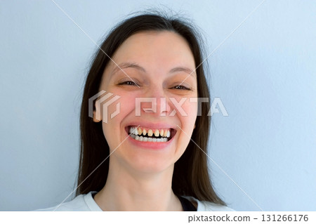 Portrait of young scary woman with yellow bad teeth laughing looking at camera. Portrait of young scary woman with yellow bad teeth laughing looking at camera. 131266176