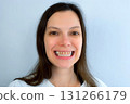 Portrait young smile woman with yellow bad teeth process dentistry prosthetics. 131266179