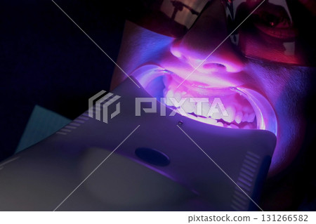 LED whitening cosmetic procedure for woman's teeth in stomatology, closeup. LED whitening cosmetic procedure for woman's teeth in stomatology, closeup. 131266582