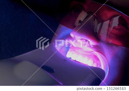 LED whitening cosmetic procedure for woman's teeth in dentistry studio, closeup. LED whitening cosmetic procedure for woman's teeth in dentistry studio, closeup. 131266583