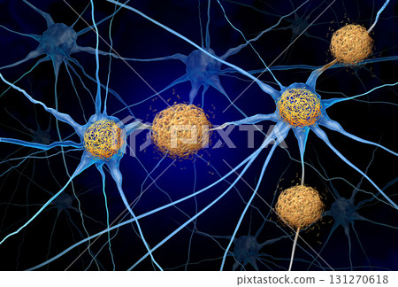Tau Tangles And Amyloid Beta 131270618