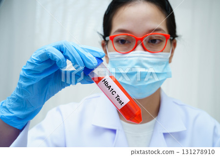 Scientist use HbA1C test tube to check level of blood glucose sugar. Scientist use HbA1C test tube to check level of blood glucose sugar. 131278910