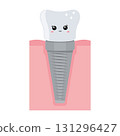 A dental implant, a kawaii character. Screw prosthesis, Illustration of dental implantation,orthodontic dental implantation 131296427