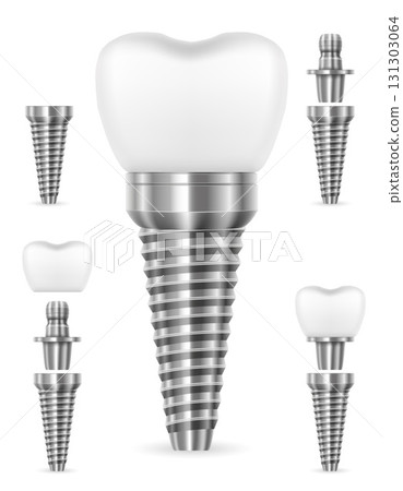 tooth metal human implant cartoon stock vector illustration 131303064