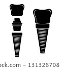 Dental implant, silhouette icon. Screw prosthesis, Illustration of dental implantation,orthodontic dental implantation 131326708