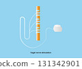 Vagal nerve stimulation (VNS). Neuromodulation device for treatment of epilepsy 131342901