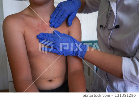 The boy shows symptoms of a skin allergy during the check-up. The boy shows symptoms of a skin allergy during the check-up. 131351280