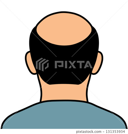 Bald head "AI generated image" Bald head "AI generated image" 131353934