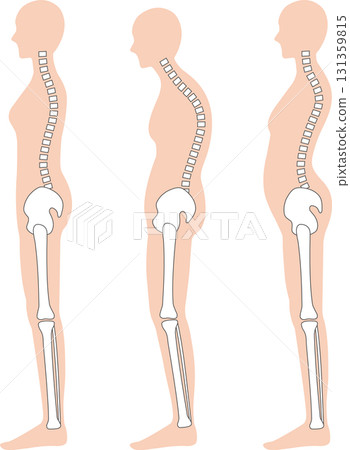 Woman with correct posture: spine and pelvis 131359815