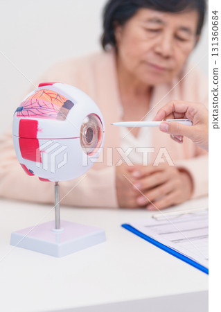 Elderly Patient consulting Doctor to Eye disease, Senior Medical Diagnosis. Anatomy Eye model for Cataract, Glaucoma, Age Related Macular Degeneration, Diabetic Retinopathy, Vitreous, health concept Elderly Patient consulting Doctor to Eye disease, Senior Medical Diagnosis. Anatomy Eye model for Cataract, Glaucoma, Age Related Macular Degeneration, Diabetic Retinopathy, Vitreous, health concept 131360684