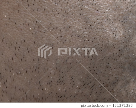 skin of the man's face with stubble and flaky skin, sparse gray hairs in the beard. 131371383