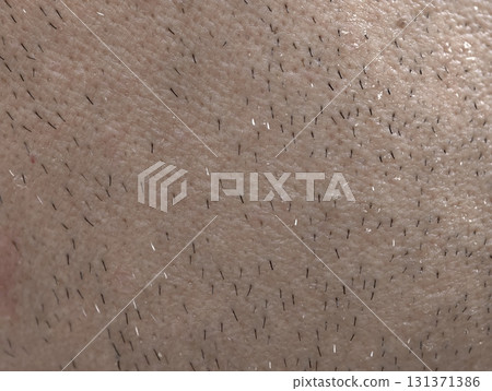 skin of the man's face with stubble and flaky skin, sparse gray hairs in the beard. 131371386