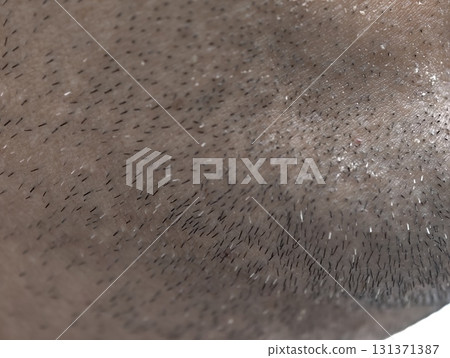 skin of the man's face with stubble and flaky skin, sparse gray hairs in the beard. 131371387