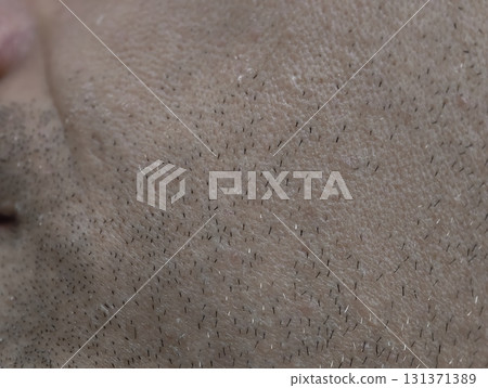 skin of the man's face with stubble and flaky skin, sparse gray hairs in the beard. 131371389