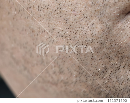 skin of the man's face with stubble and flaky skin, sparse gray hairs in the beard. 131371390