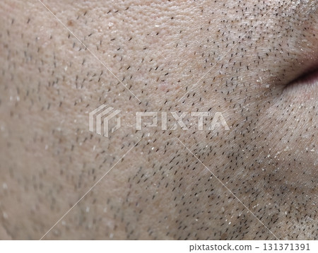 skin of the man's face with stubble and flaky skin, sparse gray hairs in the beard. 131371391