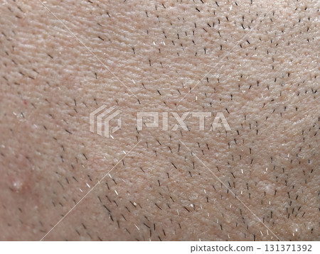 skin of the man's face with stubble and flaky skin, sparse gray hairs in the beard. 131371392