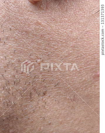 skin of the man's face with stubble and flaky skin, sparse gray hairs in the beard. 131371393