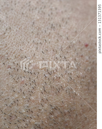 skin of the mans face with stubble and flaky skin, sparse gray hairs in the beard. 131371395