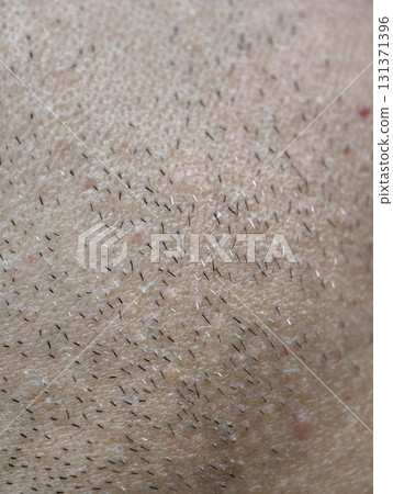 skin of the mans face with stubble and flaky skin, sparse gray hairs in the beard. 131371396