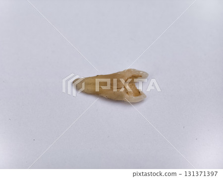 Pulled out, cracked and damaged tooth, second premolar on a white background 131371397