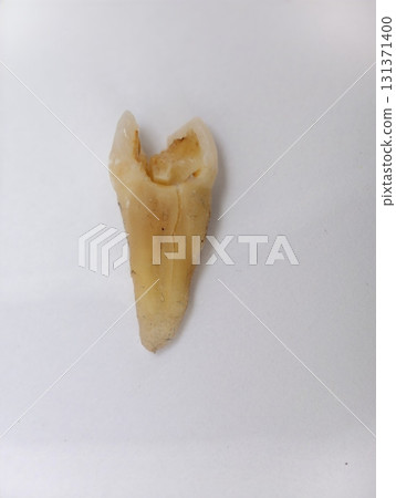 Pulled out cracked and damaged tooth, second premolar on a white background Pulled out cracked and damaged tooth, second premolar on a white background 131371400