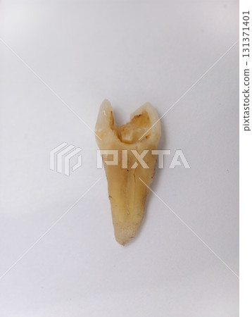Pulled out cracked and damaged tooth, second premolar on a white background Pulled out cracked and damaged tooth, second premolar on a white background 131371401