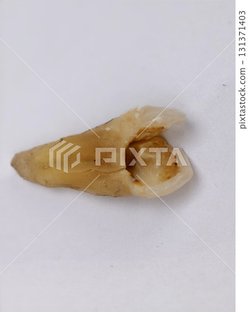 Pulled out cracked and damaged tooth, second premolar on a white background Pulled out cracked and damaged tooth, second premolar on a white background 131371403