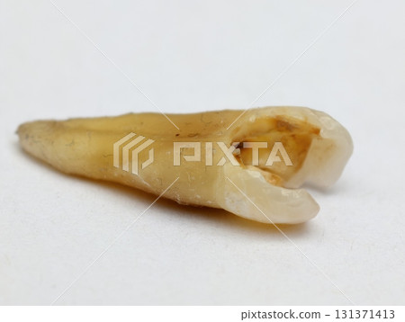 Pulled out cracked and damaged tooth, second premolar on a white background Pulled out cracked and damaged tooth, second premolar on a white background 131371413