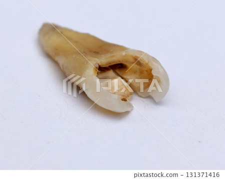 Pulled out cracked and damaged tooth, second premolar on a white background Pulled out cracked and damaged tooth, second premolar on a white background 131371416